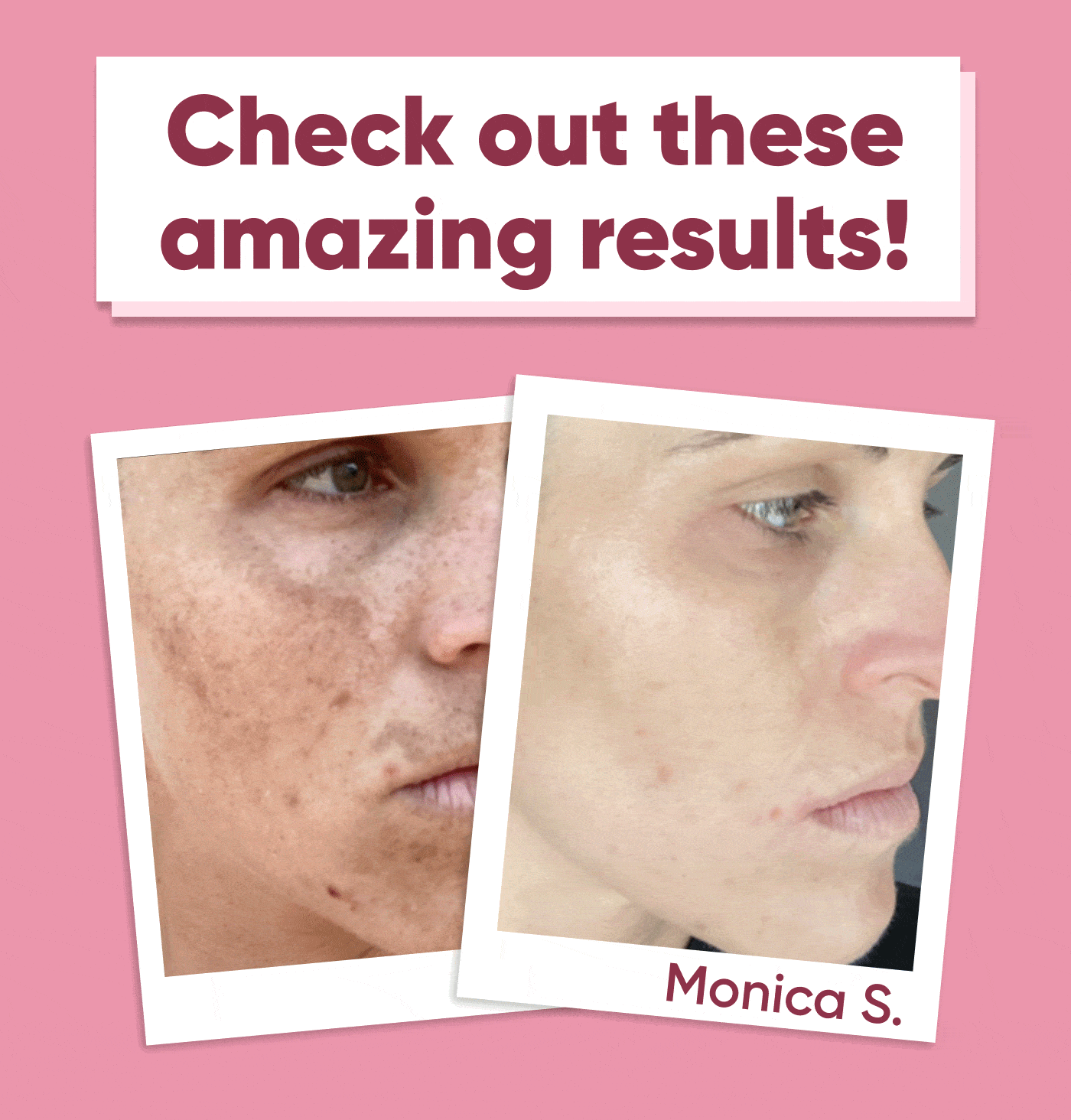 Check out these - amazing results! 