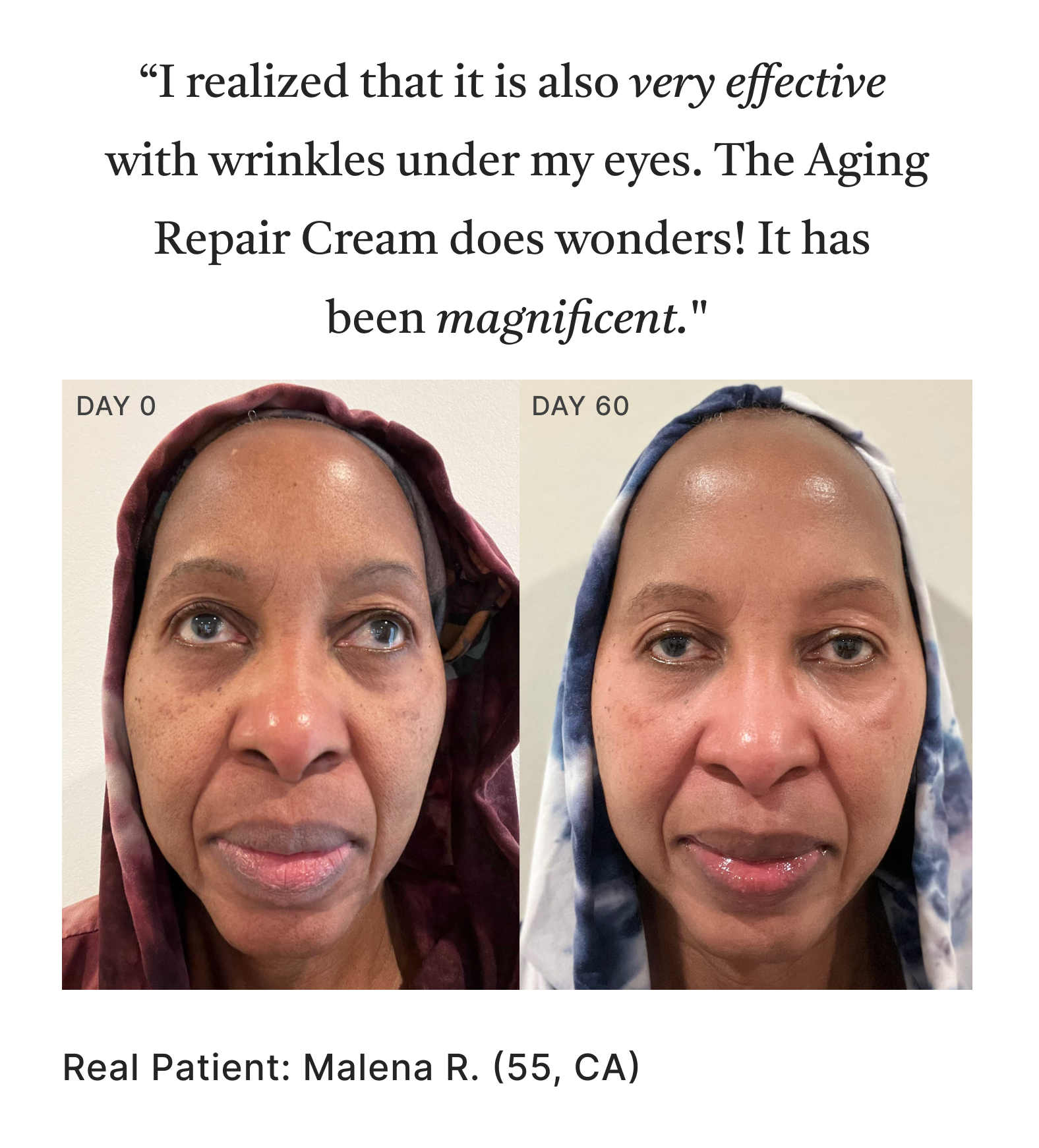 NEW: Patients Are Loving The Aging Repair Cream! 🌟 - Musely